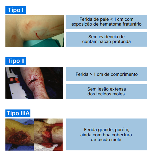 Trauma abdominal tipos